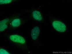 CoraLite Plus 488-conjugated RIF1 Rabbit Polyclonal Antibody, Proteintech:Antibodies:Primary