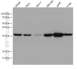 RNASEH2A Mouse Monoclonal Antibody, Proteintech 150 &mu;L | Buy Online | Proteintech | Fisher Scientific