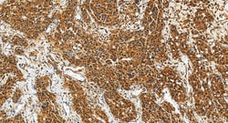 RNF113A Rabbit Polyclonal Antibody, Proteintech Unconjugated; 150 &mu;L:Antibodies,