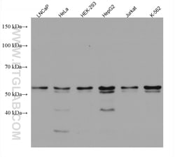 RNMT Mouse Monoclonal Antibody, Proteintech Unconjugated; 20 &mu;L:Antibodies,