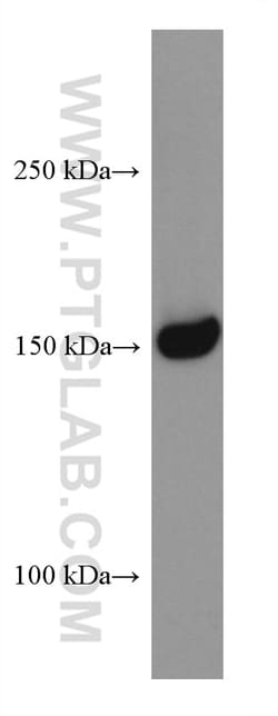 RON, MST1R Mouse Monoclonal Antibody, Proteintech Unconjugated; 20 &mu;L:Antibodies,