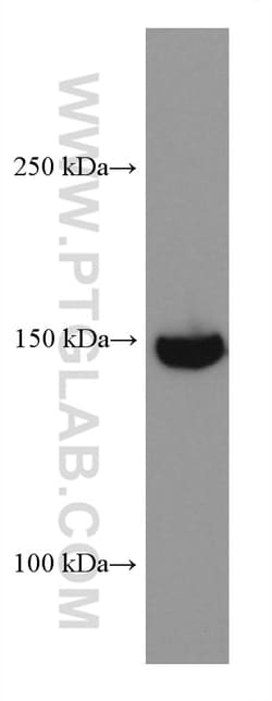 RON, MST1R Mouse Monoclonal Antibody, Proteintech Unconjugated; 20 &mu;L:Antibodies,