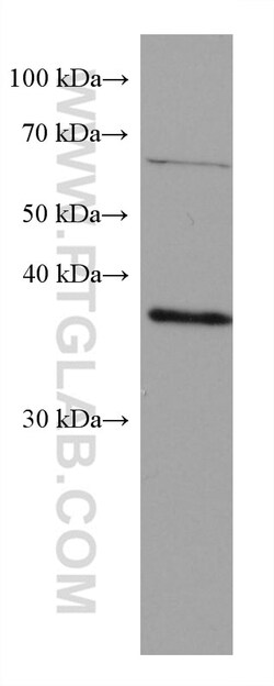 RP2 Mouse Monoclonal Antibody, Proteintech Unconjugated; 20 &mu;L:Antibodies,