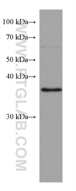 RP2 Mouse Monoclonal Antibody, Proteintech Unconjugated; 20 &mu;L:Antibodies,