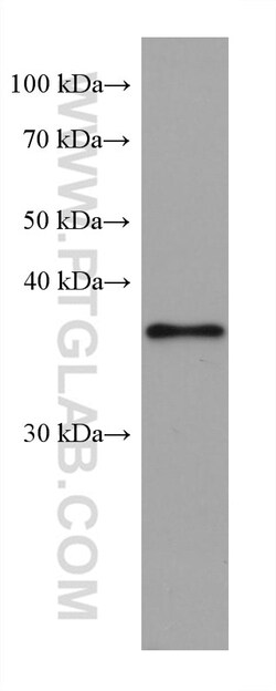 RP2 Mouse Monoclonal Antibody, Proteintech Unconjugated; 20 &mu;L:Antibodies,
