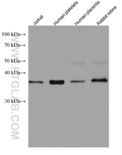 RP2 Mouse Monoclonal Antibody, Proteintech Unconjugated; 20 &mu;L:Antibodies,