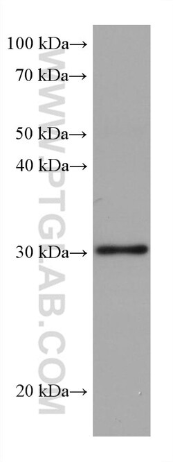 RPA2 Mouse Monoclonal Antibody, Proteintech:Antibodies:Primary Antibodies