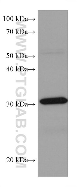 RPA2 Mouse Monoclonal Antibody, Proteintech:Antibodies:Primary Antibodies