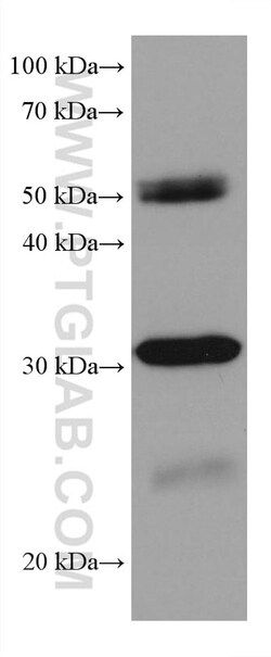 RPA2 Mouse Monoclonal Antibody, Proteintech:Antibodies:Primary Antibodies