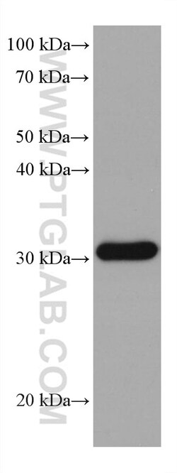 RPA2 Mouse Monoclonal Antibody, Proteintech:Antibodies:Primary Antibodies