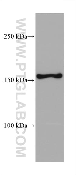 RPAP1 Mouse Monoclonal Antibody, Proteintech Unconjugated; 150 &mu;L:Antibodies,