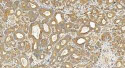 RPL13A Rabbit Polyclonal Antibody, Proteintech:Antibodies:Primary Antibodies