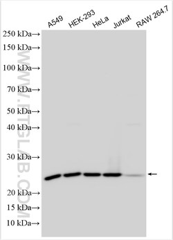RPL13A Rabbit Polyclonal Antibody, Proteintech:Antibodies:Primary Antibodies