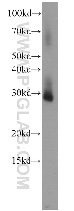 RPL13A Rabbit Polyclonal Antibody, Proteintech:Antibodies:Primary Antibodies