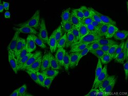 RPL14 Rabbit Recombinant Antibody, Proteintech:Antibodies:Primary Antibodies