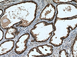 RPL5 Rabbit Polyclonal Antibody, Proteintech Unconjugated; 150 &mu;L:Antibodies,