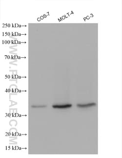RPL5 Rabbit Polyclonal Antibody, Proteintech Unconjugated; 150 &mu;L:Antibodies,