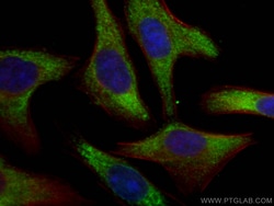 RPL6 Mouse Monoclonal Antibody, Proteintech Unconjugated; 20 &mu;L:Antibodies,