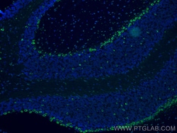 RPL9 Mouse Monoclonal Antibody, Proteintech Unconjugated; 20 &mu;L:Antibodies,