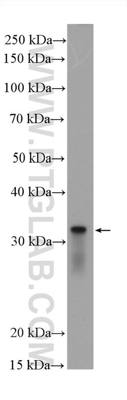 S6 Ribosomal protein Rabbit Recombinant Antibody, Proteintech Unconjugated;