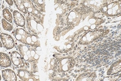 RSL1D1 Rabbit Polyclonal Antibody, Proteintech:Antibodies:Primary Antibodies