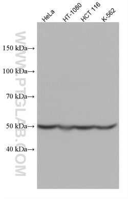 RUVBL1 Mouse Monoclonal Antibody, Proteintech Unconjugated; 150 &mu;L:Anticuerpos