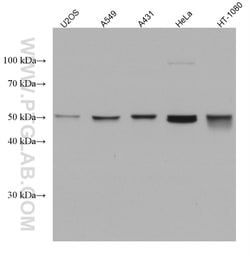 RUVBL1 Mouse Monoclonal Antibody, Proteintech Unconjugated; 150 &mu;L:Anticuerpos