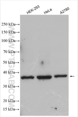 Rad51D Rabbit Polyclonal Antibody, Proteintech:Antibodies:Primary Antibodies