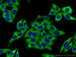 Ribosomal protein L4 Rabbit Polyclonal Antibody, Proteintech Unconjugated;