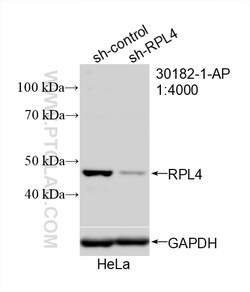 Ribosomal protein L4 Rabbit Polyclonal Antibody, Proteintech Unconjugated;