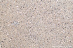 SAA1 Rabbit Polyclonal Antibody, Proteintech Unconjugated; 150 &mu;L:Antibodies,