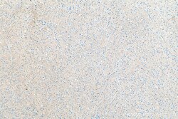 SAA1 Rabbit Polyclonal Antibody, Proteintech Unconjugated; 150 &mu;L:Antibodies,