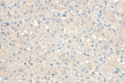SAA1 Rabbit Polyclonal Antibody, Proteintech Unconjugated; 150 &mu;L:Antibodies,