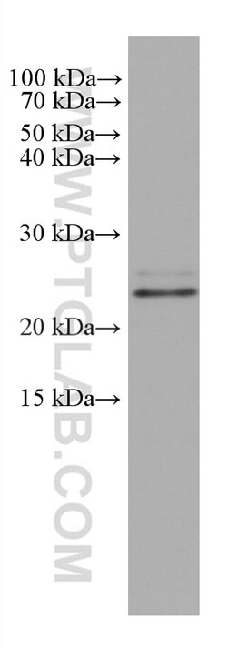 SAR1B Mouse Monoclonal Antibody, Proteintech:Antibodies:Primary Antibodies