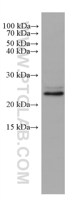 SAR1B Mouse Monoclonal Antibody, Proteintech:Antibodies:Primary Antibodies