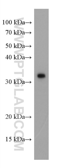 SARS-CoV-2 S protein (944-1214 aa) Mouse Monoclonal Antibody, Proteintech