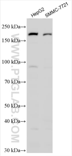 SCARF1 Rabbit Polyclonal Antibody, Proteintech Unconjugated; 150 &mu;L:Antibodies,