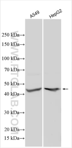 SCML1 Rabbit Polyclonal Antibody, Proteintech:Antistoffer:Primære antistoffer
