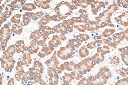 SEC22C Rabbit Polyclonal Antibody, Proteintech:Antibodies:Primary Antibodies