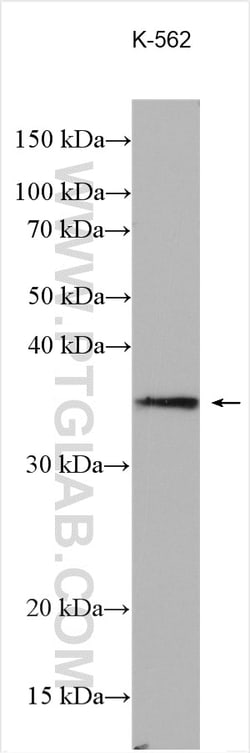 SEC22C Rabbit Polyclonal Antibody, Proteintech:Antibodies:Primary Antibodies