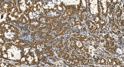 SEC23B Rabbit Polyclonal Antibody, Proteintech:Antibodies:Primary Antibodies