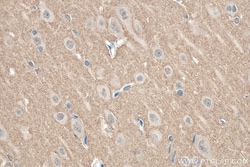 SEPT3 Rabbit Polyclonal Antibody, Proteintech Unconjugated; 20 &mu;L:Antibodies,