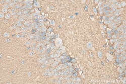 SEPT3 Rabbit Polyclonal Antibody, Proteintech Unconjugated; 20 &mu;L:Antibodies,