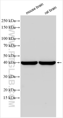 SEPT3 Rabbit Polyclonal Antibody, Proteintech Unconjugated; 20 &mu;L:Antibodies,