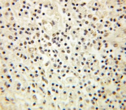 SERBP1 Rabbit Polyclonal Antibody, Proteintech Unconjugated; 150 &mu;L:Antibodies,
