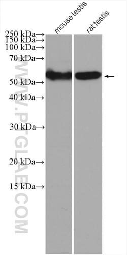 SERBP1 Rabbit Polyclonal Antibody, Proteintech Unconjugated; 150 &mu;L:Antibodies,