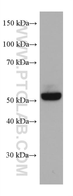 SERBP1 Mouse Monoclonal Antibody, Proteintech Unconjugated; 20 &mu;L:Anticorps,