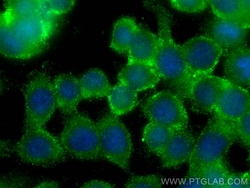 SERCA3 Mouse Monoclonal Antibody, Proteintech:Antibodies:Primary Antibodies