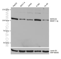 SERCA3 Mouse Monoclonal Antibody, Proteintech:Antibodies:Primary Antibodies