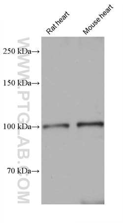 SERCA3 Mouse Monoclonal Antibody, Proteintech:Antibodies:Primary Antibodies